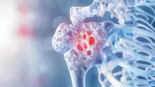 What is the Cost of a Bone Marrow Transplant?